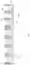 Fig. 04 - FINFET stack gate memory and method of forming thereof