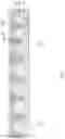 Fig. 05 - FINFET stack gate memory and method of forming thereof