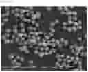 Fig. 02 - Method of preparing positive electrode active material precursor for lithium secondary battery and positive electrode active material precursor prepared by the method