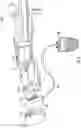 Fig. 03 - DEVICE FOR ADAPTING AN EXTERNAL CONTROL DEVICE TO A BATTERY-OPERATED POWER TOOL