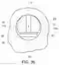 Fig. 16 - Conductor bar and associated rotor and rotating electrical machine