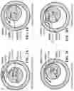 Fig. 04 - Method for static eccentricity fault detection of induction motors
