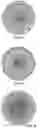 Fig. 16 - Metal layer for inductive power transfer