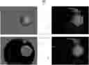 Fig. 01 - Multifocal display device and method