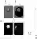 Fig. 04 - Multifocal display device and method