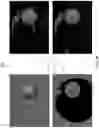 Fig. 11 - Multifocal display device and method