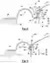 Fig. 03 - Loudspeaker assembly with a separate voice coil assembly