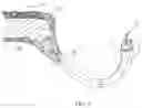 Fig. 06 - Loudspeaker apparatus