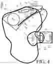 Fig. 07 - Hearing device and a hearing system comprising a multitude of adaptive two channel beamformers