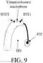 Fig. 12 - Hearing device and a hearing system comprising a multitude of adaptive two channel beamformers