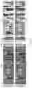 Fig. 04 - HEARING DEVICE COMPRISING A NOISE REDUCTION SYSTEM