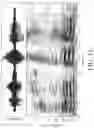 Fig. 19 - HEARING DEVICE COMPRISING A NOISE REDUCTION SYSTEM