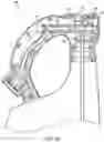 Fig. 04 - Ready-to-use hose end sprayer