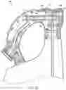 Fig. 06 - Ready-to-use hose end sprayer