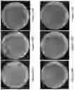 Fig. 16 - Templated antimicrobial microgels and methods of making and using the same