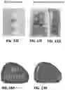 Fig. 18 - MEAT ANALOGUES AND METHODS OF PRODUCING THE SAME