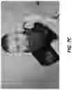 Fig. 10 - BEARD WRAP DEVICE