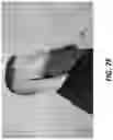 Fig. 13 - BEARD WRAP DEVICE