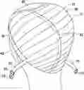 Fig. 01 - WIG CAPS
