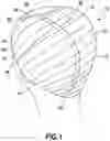 Fig. 02 - WIG CAPS