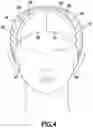 Fig. 05 - WIG CAPS