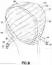 Fig. 07 - WIG CAPS