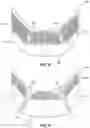 Fig. 08 - Reconfigurable brim