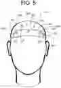 Fig. 06 - Headwear assembly