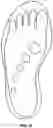 Fig. 24 - VARIABLE MATERIAL PROPERTIES FOOT COVERING