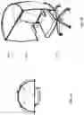 Fig. 06 - Retrofitting apparatus for a chair that extends around sides of an upper body portion of a user seated in the chair