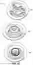 Fig. 05 - IMPROVED AIR BED VALVE