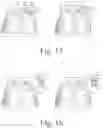 Fig. 09 - Smooch n' snore [TM]: devices to create a plurality of adjustable acoustic and/or thermal zones in a bed
