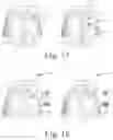 Fig. 10 - Smooch n' snore [TM]: devices to create a plurality of adjustable acoustic and/or thermal zones in a bed
