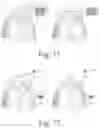 Fig. 37 - Smooch n' snore [TM]: devices to create a plurality of adjustable acoustic and/or thermal zones in a bed