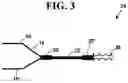 Fig. 04 - Heat resistant cooking apparatus