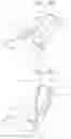 Fig. 06 - Vacuum cleaner