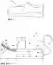 Fig. 02 - Grout cleaning attachment for a shoe