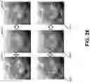 Fig. 29 - APPARATUSES AND METHODS INVOLVING MULTI-MODAL IMAGING OF A SAMPLE