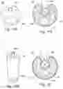 Fig. 10 - Endoscope with quick-change tubes