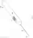 Fig. 02 - IMAGING TOOL TO SUPPORT EYE SURGERY