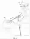Fig. 03 - Lavage and Cleansing System and Method