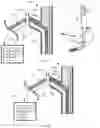 Fig. 14 - INTEGRATED ENDOSCOPE CLEANSING SYSTEM