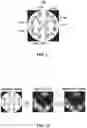 Fig. 15 - Vision testing via prediction-based setting of initial stimuli characteristics for user interface locations