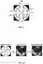 Fig. 15 - Vision testing via prediction-based setting of initial stimuli characteristics for user interface locations
