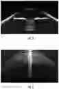 Fig. 04 - Procedural Optical Coherence Tomography (OCT) for Surgery and Related Methods