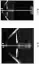 Fig. 06 - Procedural Optical Coherence Tomography (OCT) for Surgery and Related Methods