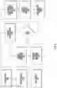 Fig. 07 - Procedural Optical Coherence Tomography (OCT) for Surgery and Related Methods