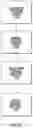 Fig. 13 - Procedural Optical Coherence Tomography (OCT) for Surgery and Related Methods