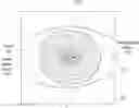 Fig. 01 - Corneal topography system operations