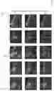 Fig. 09 - System and method for fully automatic LV segmentation of myocardial first-pass perfusion images